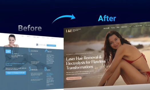 Laser by Aleya website revamp