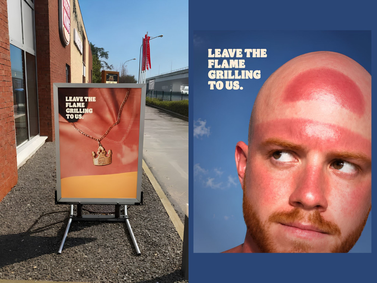 Burger King ads showing severe sunburns and distinct tan lines.