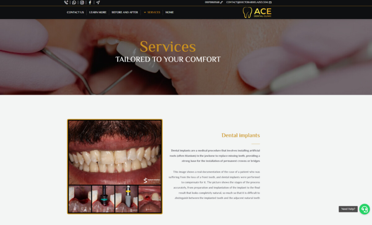 ACE Dental Clinic services section by Remal Digital Solutions.