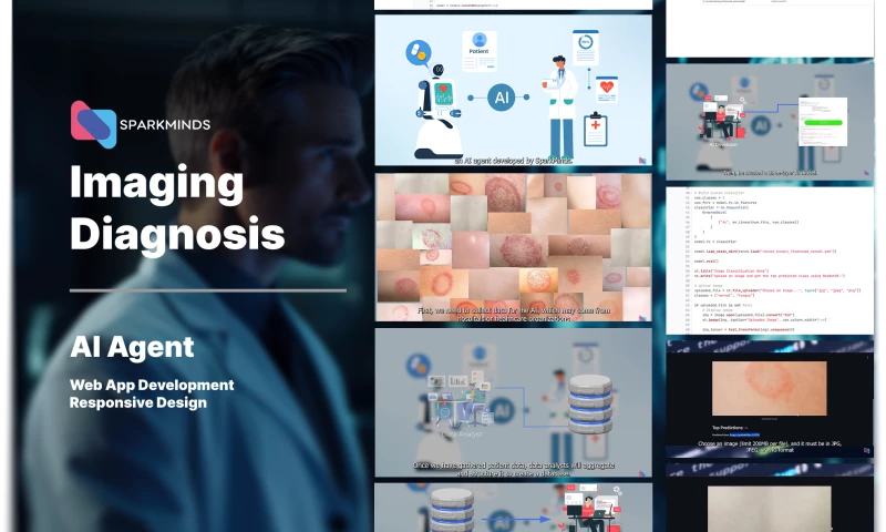 SparkMinds - AI Agent - Imaging Diagnosis