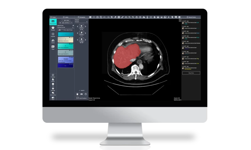 SOTATEK JSC - Medical AI Platform