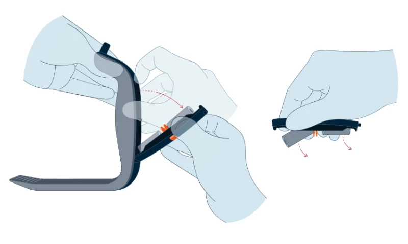 obp Surgical Illustration