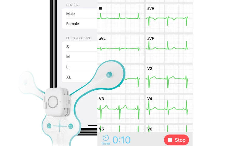 Appotype - SmartMedics ECG