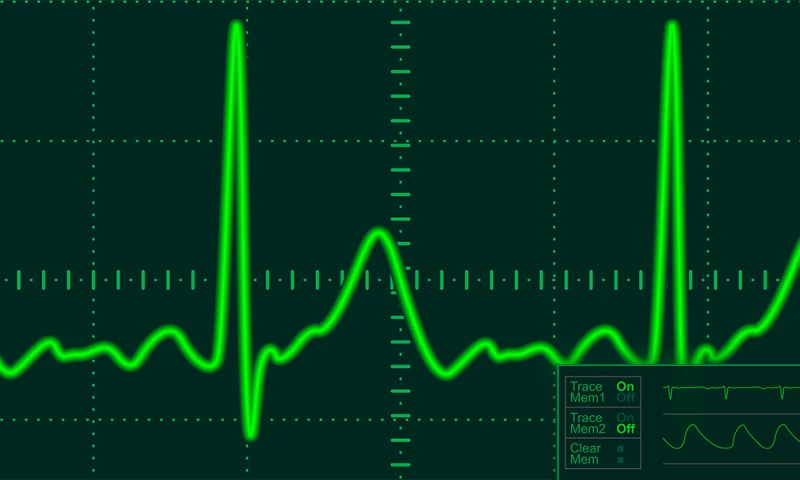 QUALITANCE - Detecting cardiovascular disorders in real time