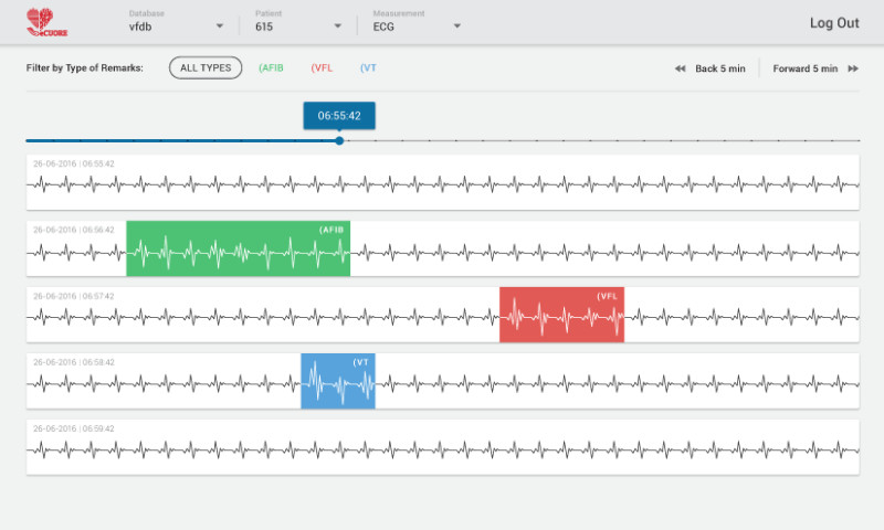 QUALITANCE - Detecting cardiovascular disorders in real time