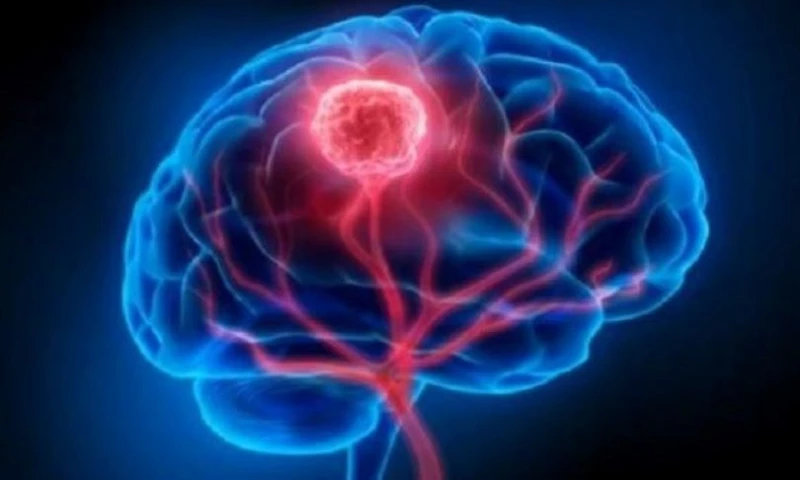 Brain Tumor Localization Application