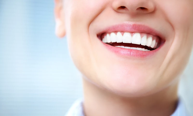 Expert teeth whitening network