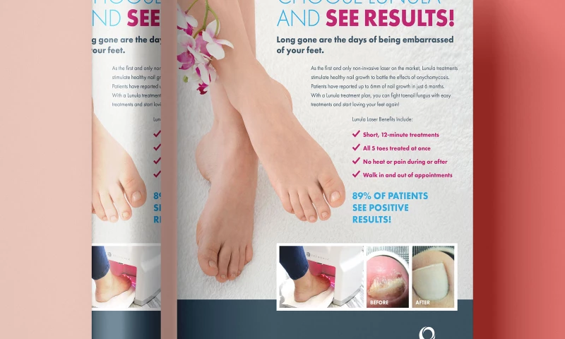 Designed.co - Lunula Laser Flyer Design