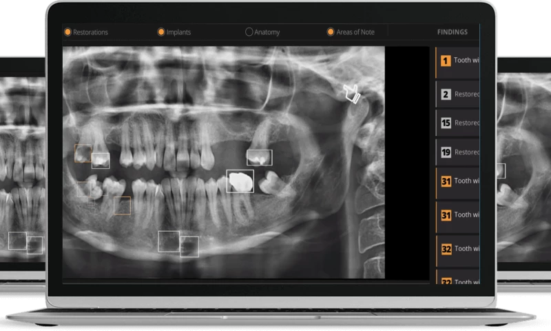 IT Idol Technologies - VELMENI