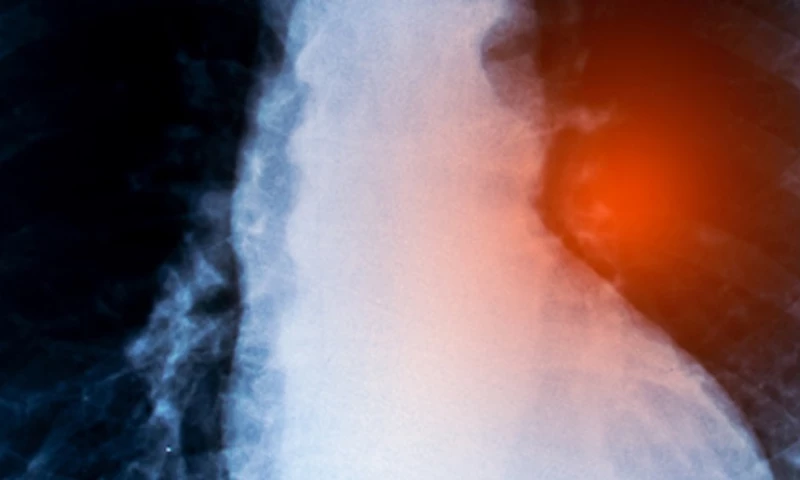 Lung Cancer Detection Application for bioAffinity Technologies