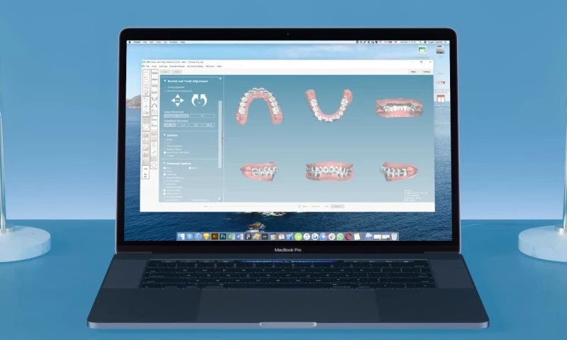 OrthoSelect - Dibs AI