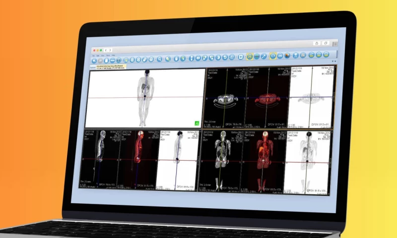 Tomographix - DICOM Image Processing Application