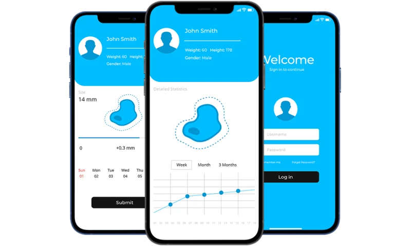 Unicsoft - Automated Melanoma Prevention & Detection