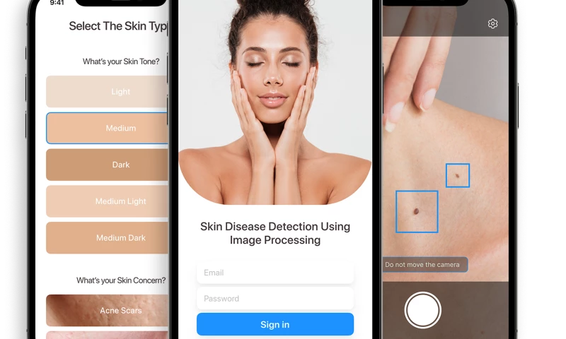 Unicsoft - Skin Disease Detection with AI-Powered Image Recognition