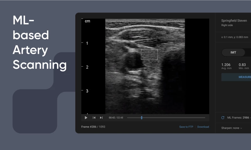 WaveAccess - ML-based automated workplace for artery scanning
