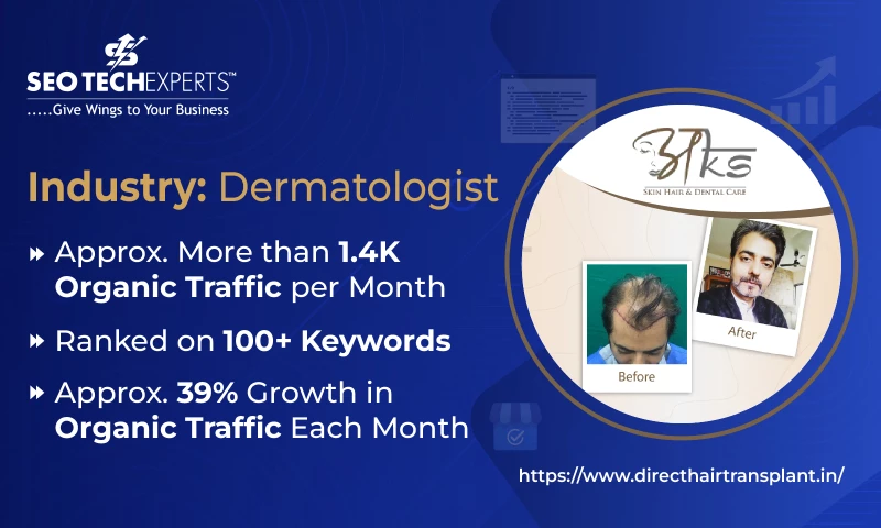 SEO Tech Experts Pvt Ltd - AKS Hair Transplant Clinic Gurgaon