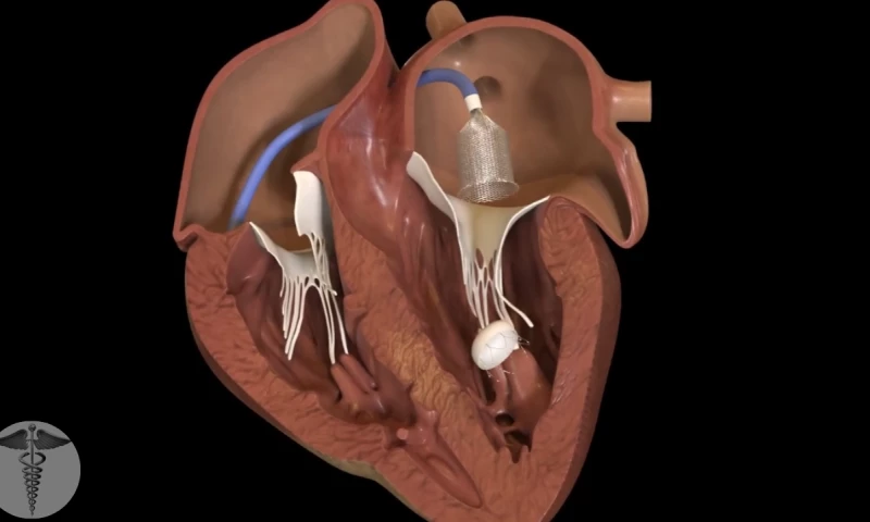 Medical 3D Animation Company