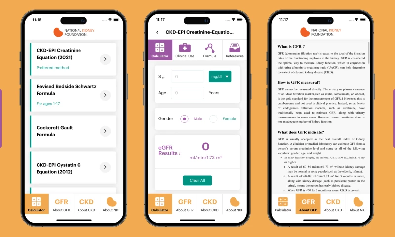 Quartus Technology, Inc - National Kidney Foundation- eGFR Calculators