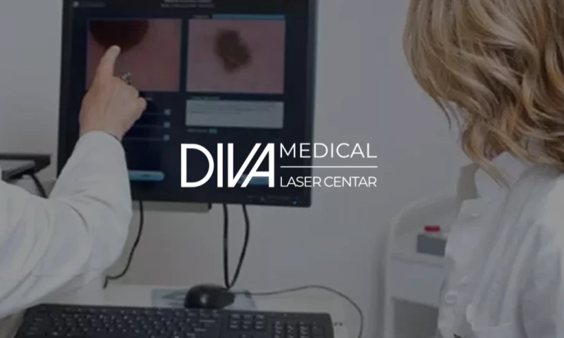 Content & Concept - Diva Laser Centar