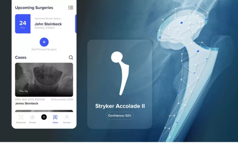 AI-powered implant identification with up to 99% certainty