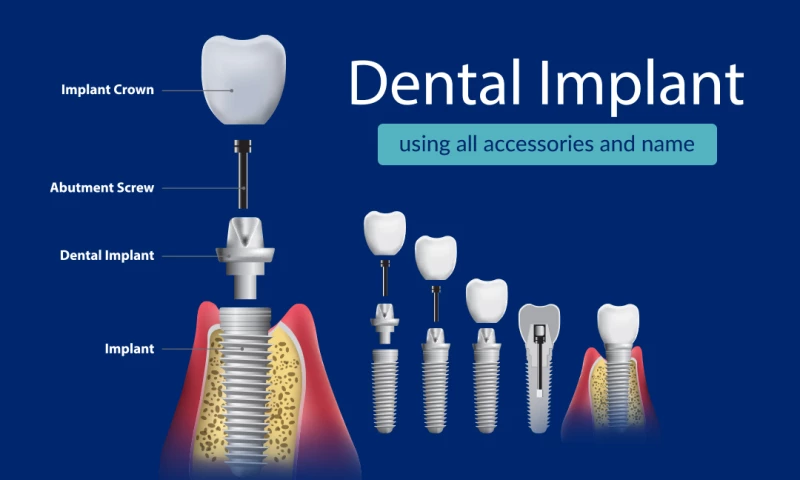 Evoquesys - The Partha's Dental Clinic