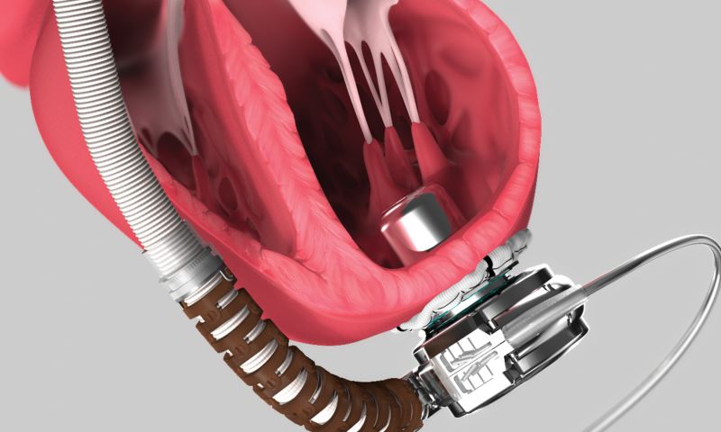 AXS Studio - VAD Medical Device Animation