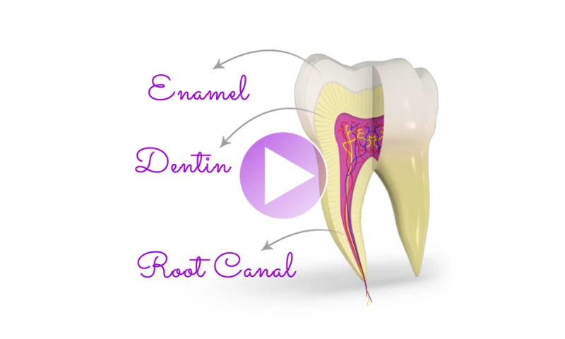Siva Solutions Inc. - 3D Dental Patient Education Videos