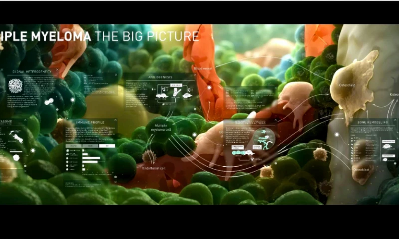 AXS Studio - Multiple Myeloma Experience Wall