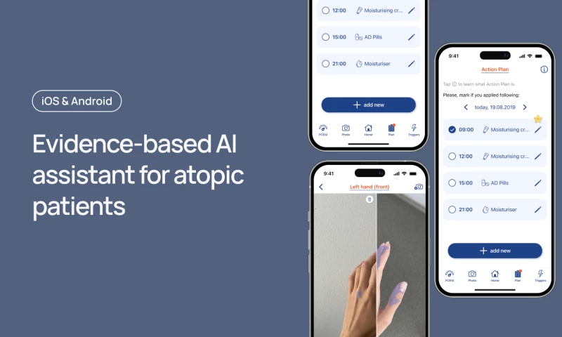 AI assistant for atopic patients