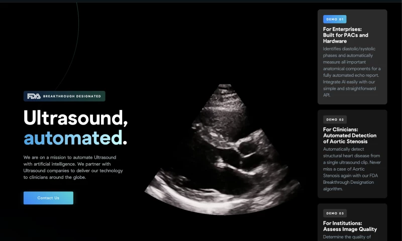 AI-Powered Echocardiogram Labeling