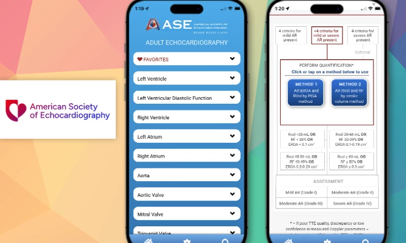 Mobile app to assist diagnosis of heart conditions