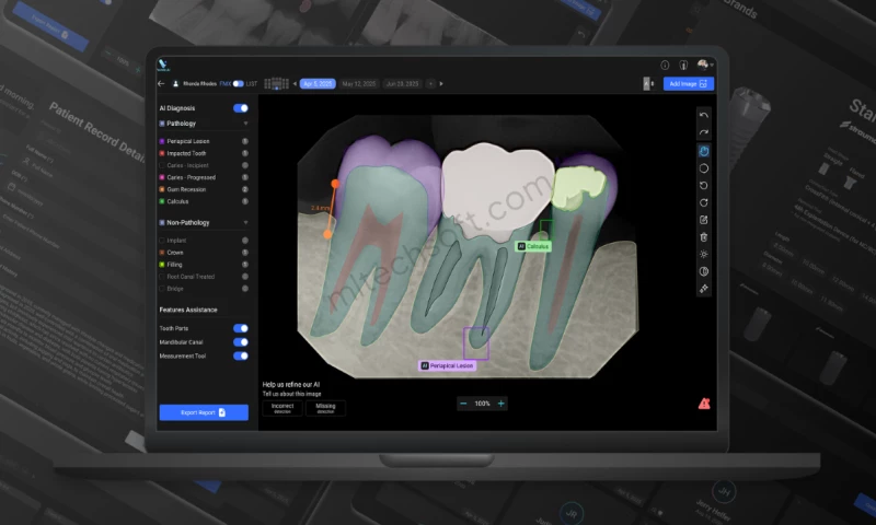 AI-Powered Dental Diagnosis System