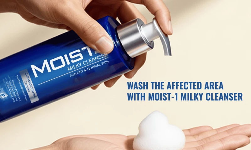 Develovent Network - Moist-1 Summer Campaign