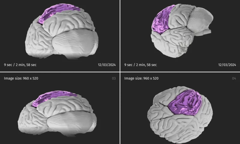 Timspark - 3D Medical Imaging Software Development
