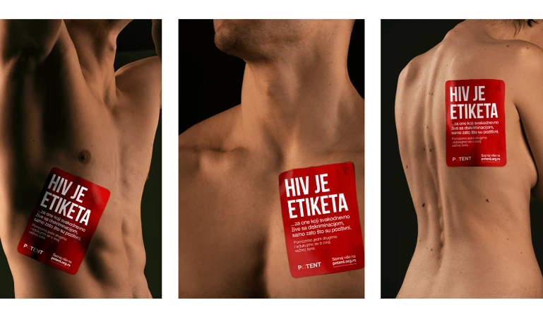 HIV is a LABEL by Direct Media United Solutions