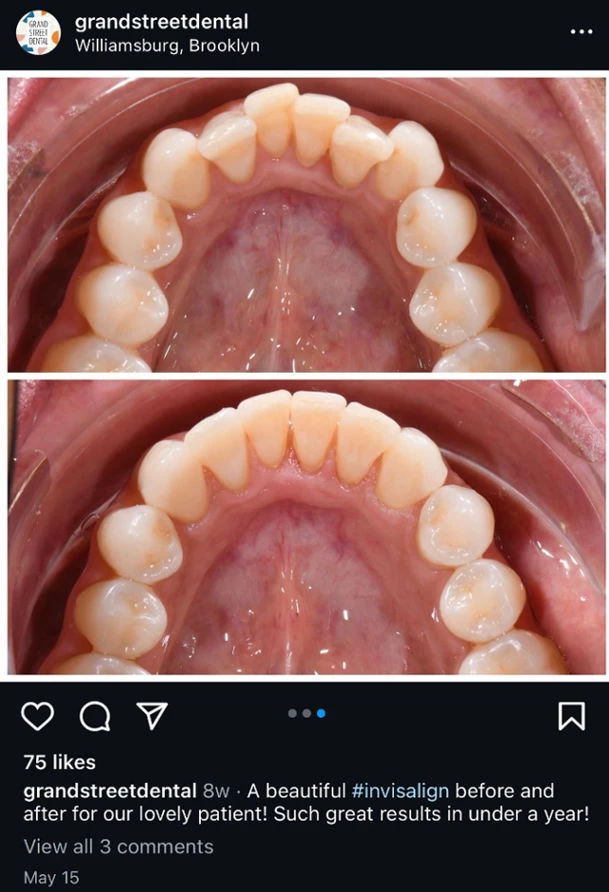 grandstreetdental on Instagram grandstreetdental on Instagram