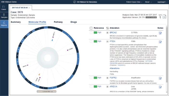 IBM Watson interface
