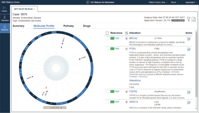 IBM Watson interface